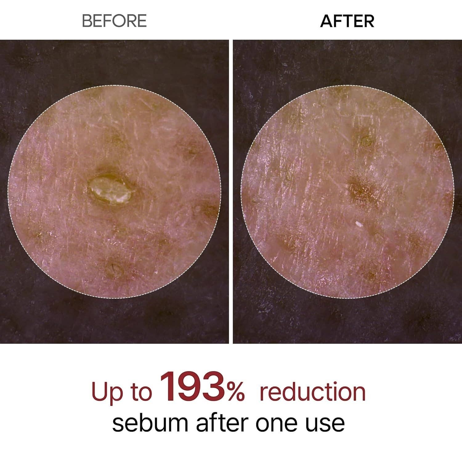 Doodlations Coffee Bar & Boutique DR MELAXIN Peel Shot Glow White Rice Peeling Ampoule before and after skin texture comparison showing sebum reduction.